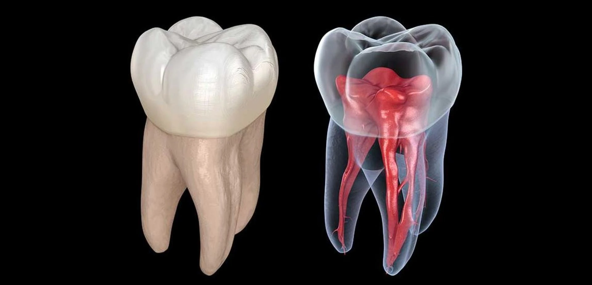 Affordable Root Canal Treatment Cost: How to Plan Your Budget