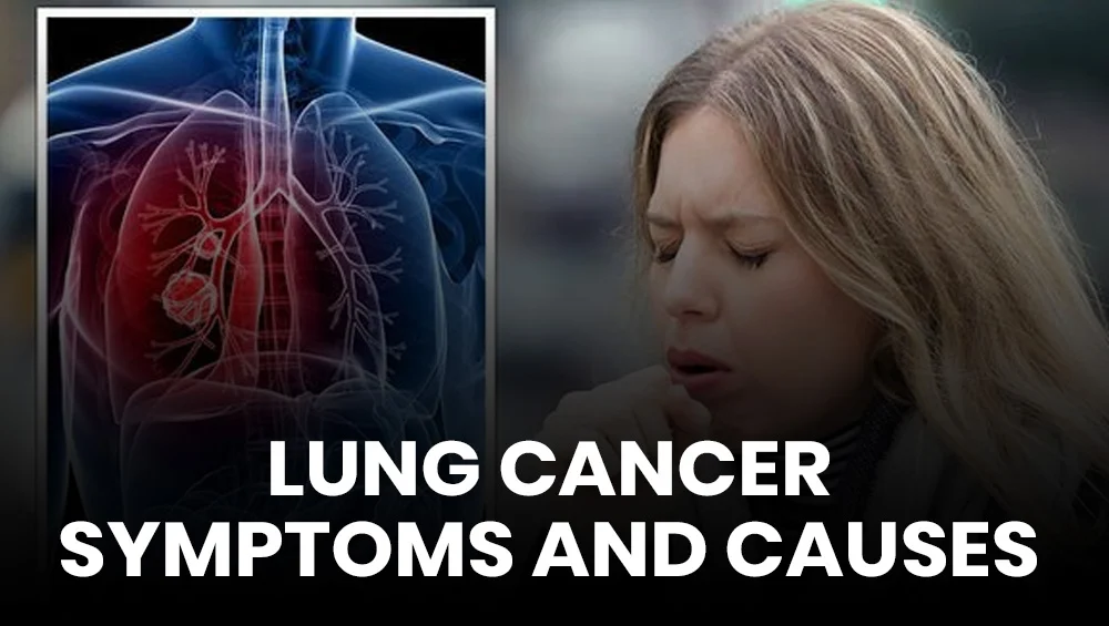 Lung Cancer – Symptoms and Causes