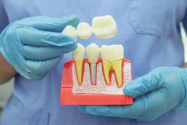 Types of Dental Crowns and Their Benefits