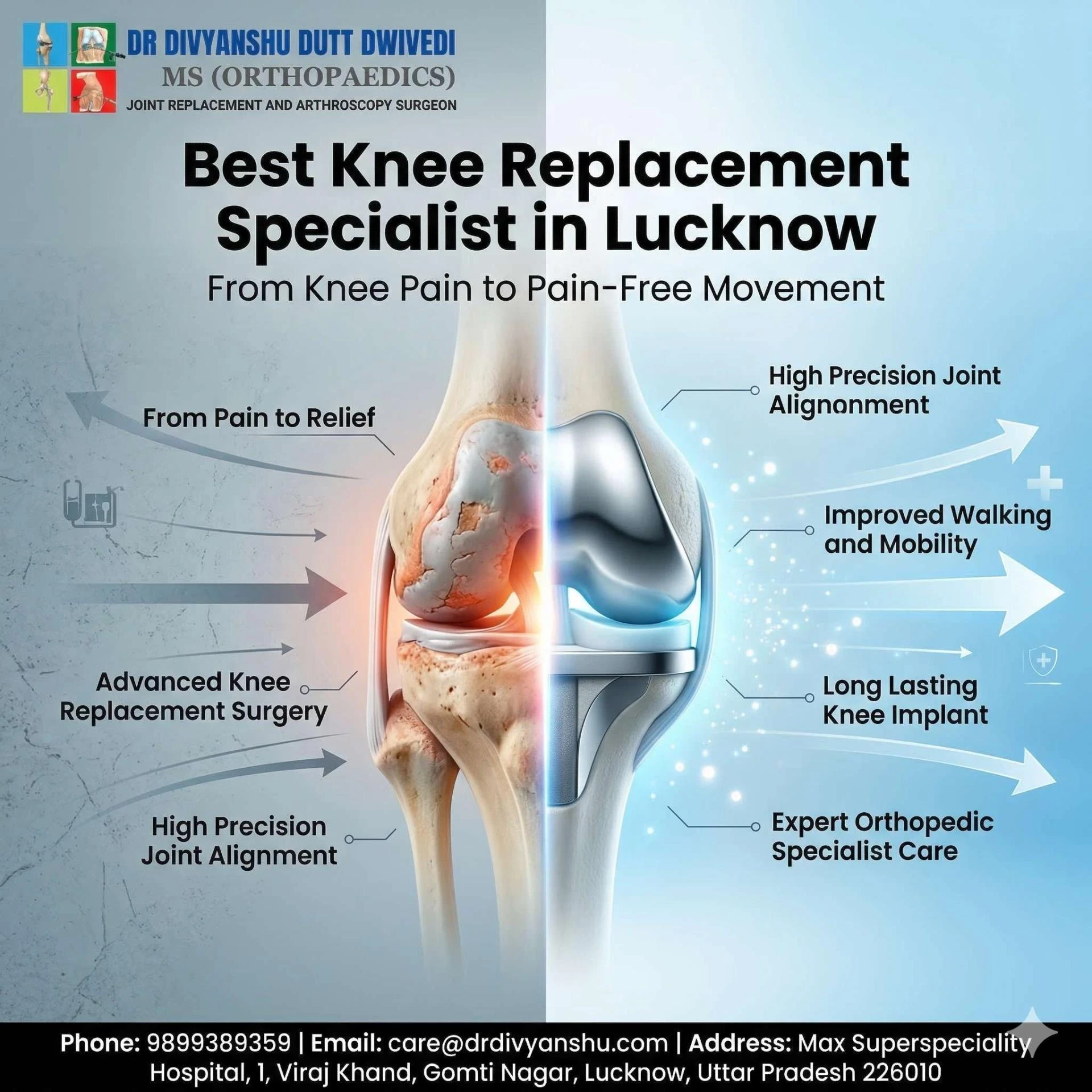 How New Small-Cut Surgery Helps You Walk Sooner Under the Best Knee Replacement Surgeon in Lucknow