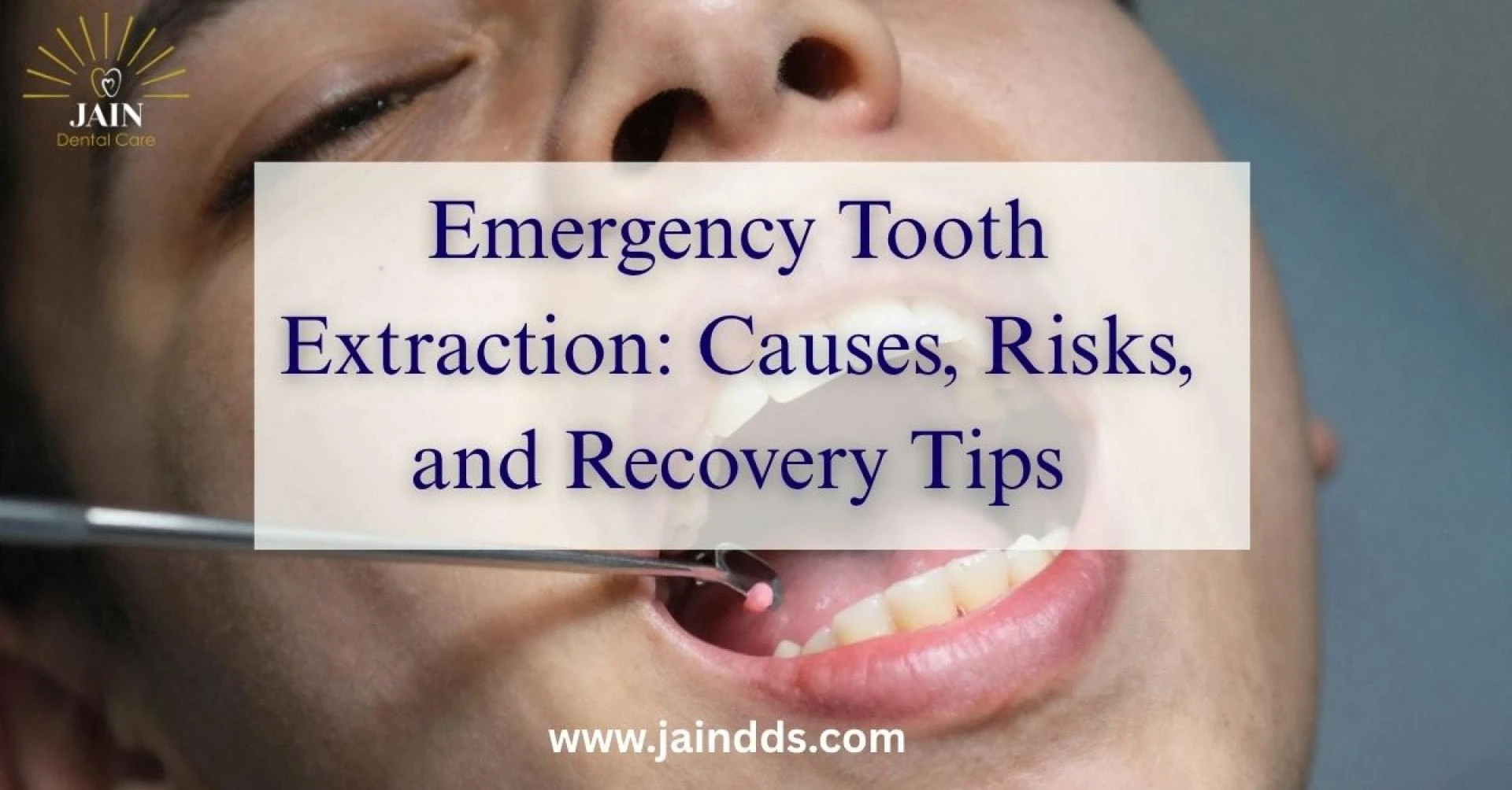 🦷 Emergency Tooth Extraction: Causes, Risks & Healing Guide