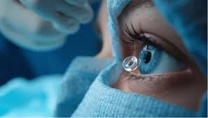 From Consultation to Clarity: Your Complete Eye Surgery Journey Explained