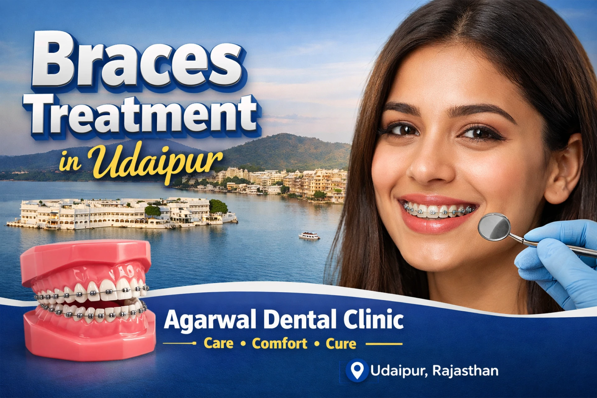 Typical Costs of Braces Treatment in Modern Dentistry