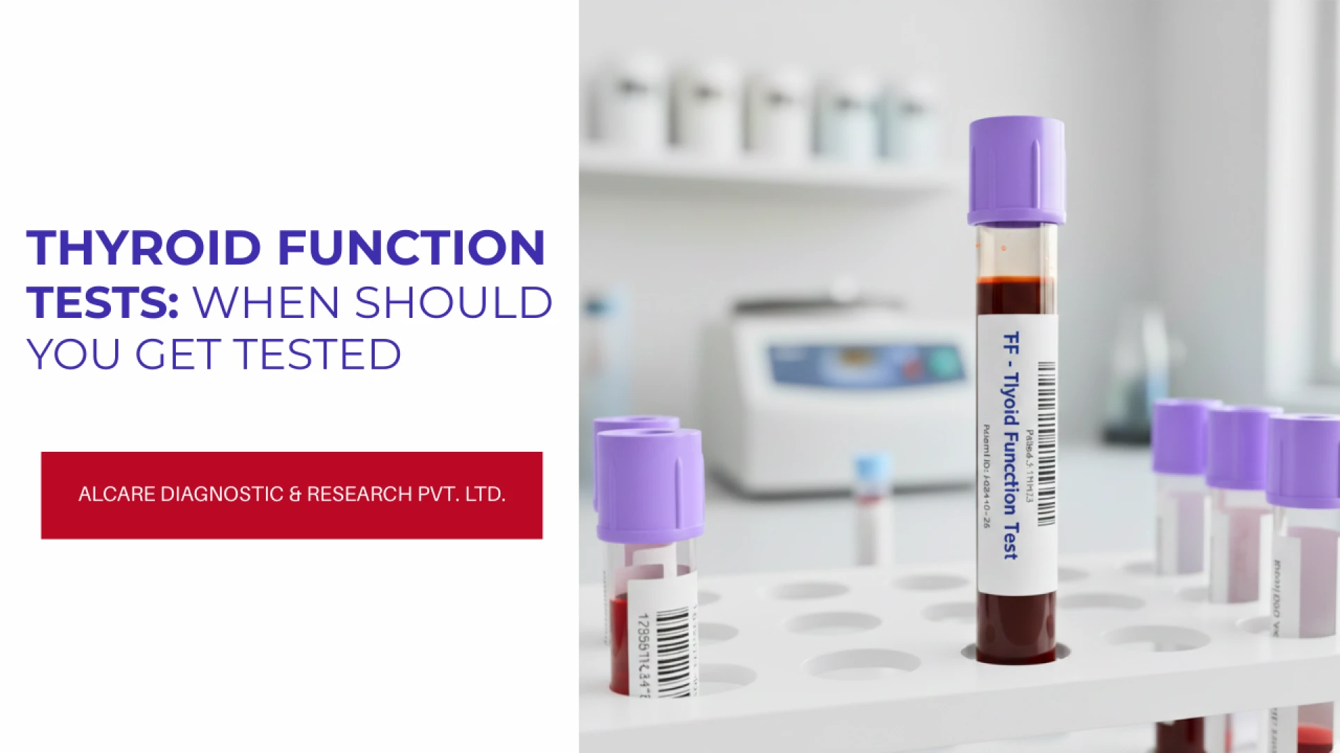 Thyroid Function Tests: When Should You Get Tested?