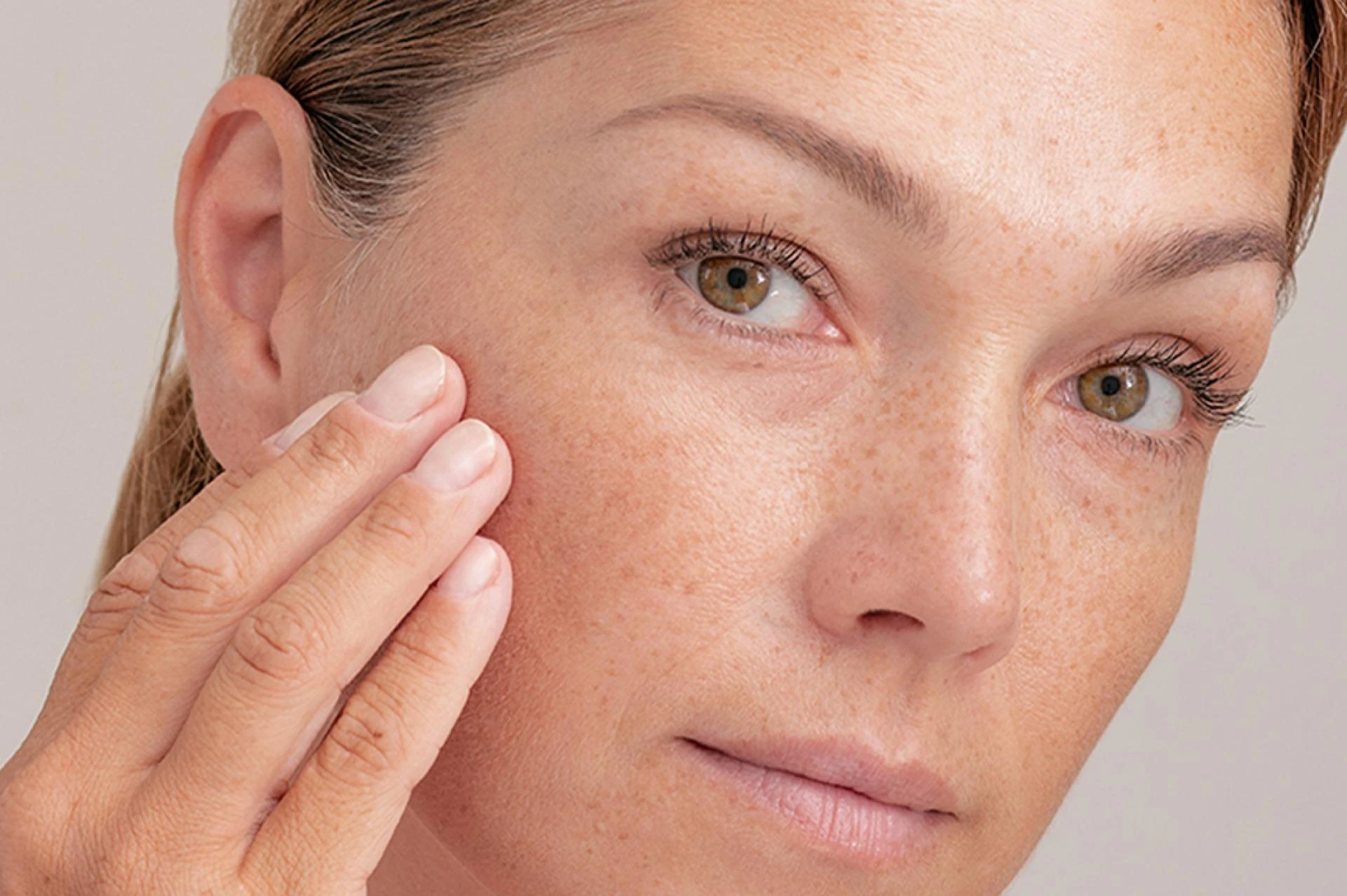 Why Those Dark Patches Appear and How to Treat Them Right