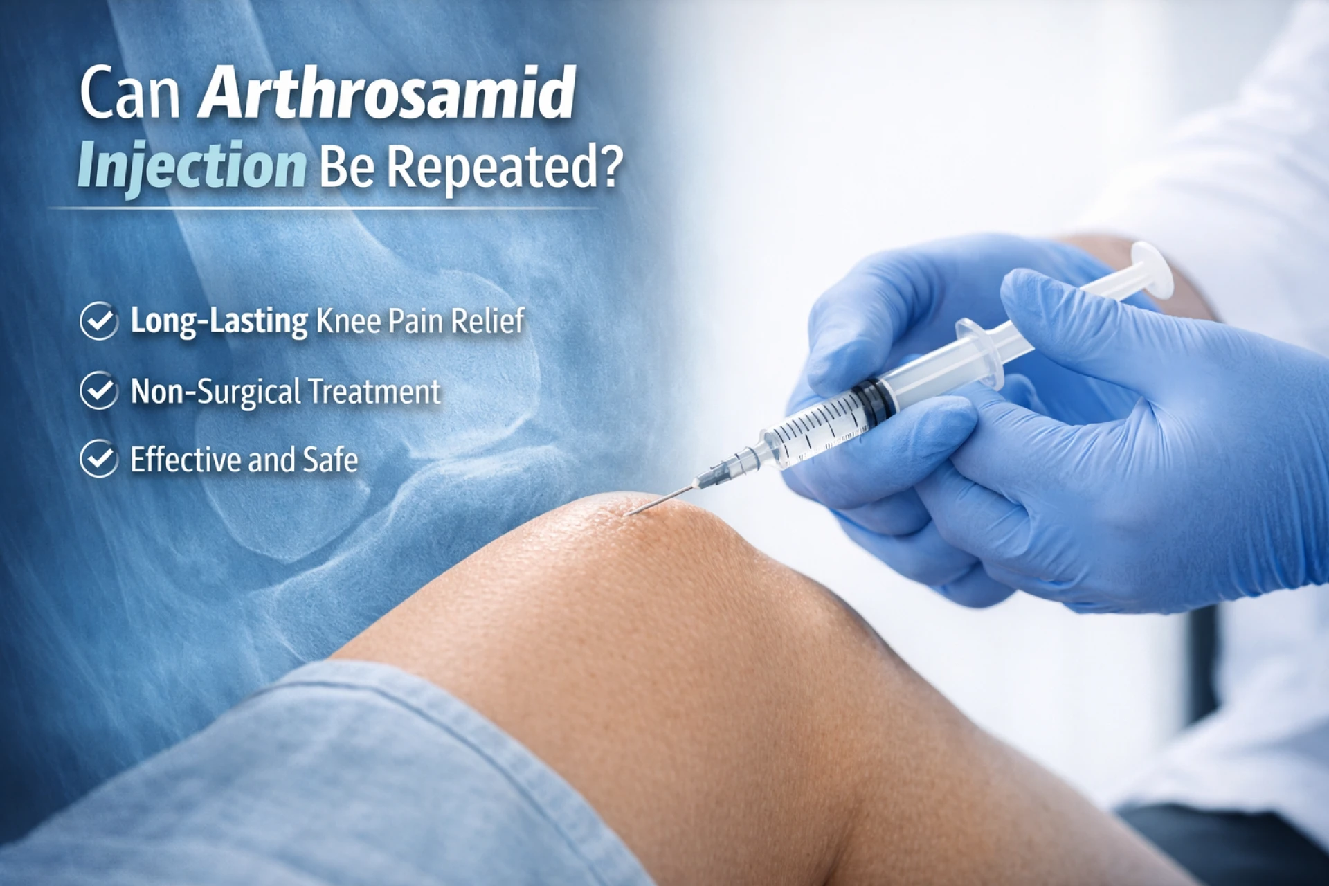 Can Arthrosamid Injection Be Repeated? Cost, Benefits & Long-Term Results Explained