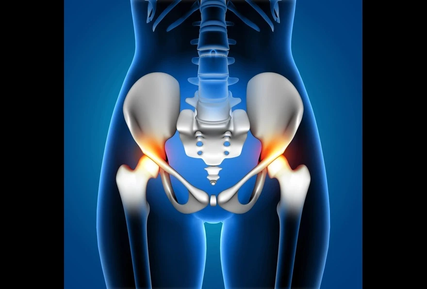 Total Hip Replacement Surgery in Delhi: Recovery Stages Explained by Orthopaedic Surgeon