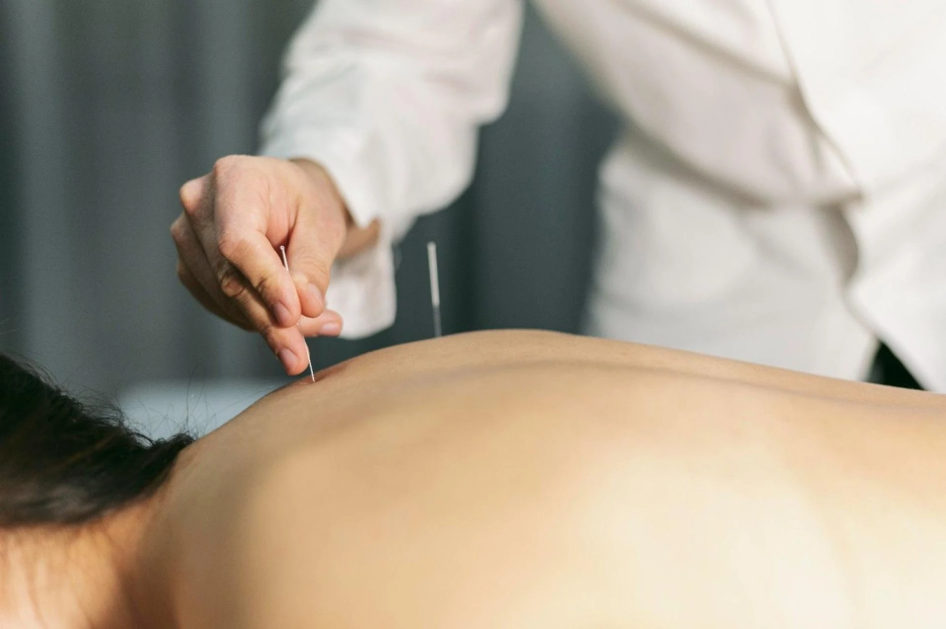 The Healing within: Why you ought to think about acupuncture as a means of whole-body healing