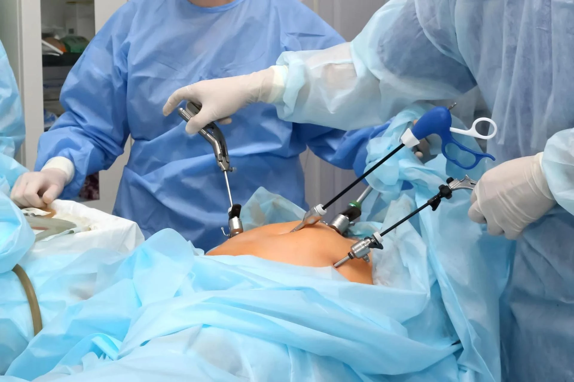 How Laparoscopic Surgery Changes Patient Experiences?