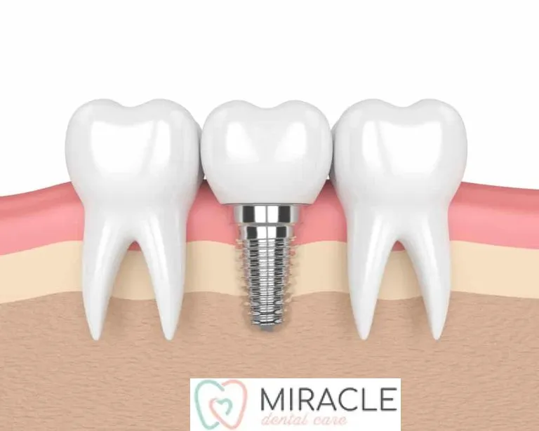 Trusted Family Dental Care Across Campsie and Surrounding Suburbs