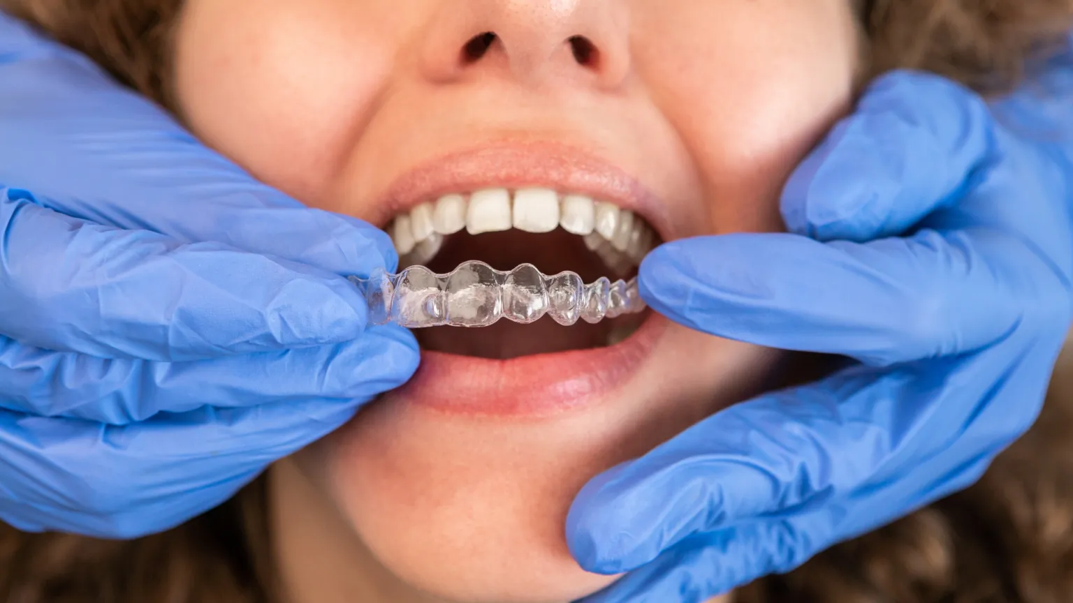 Atwell Smiles – Trusted Dentist Cockburn, Emergency Dentist Cockburn & Dentist Aubin Grove
