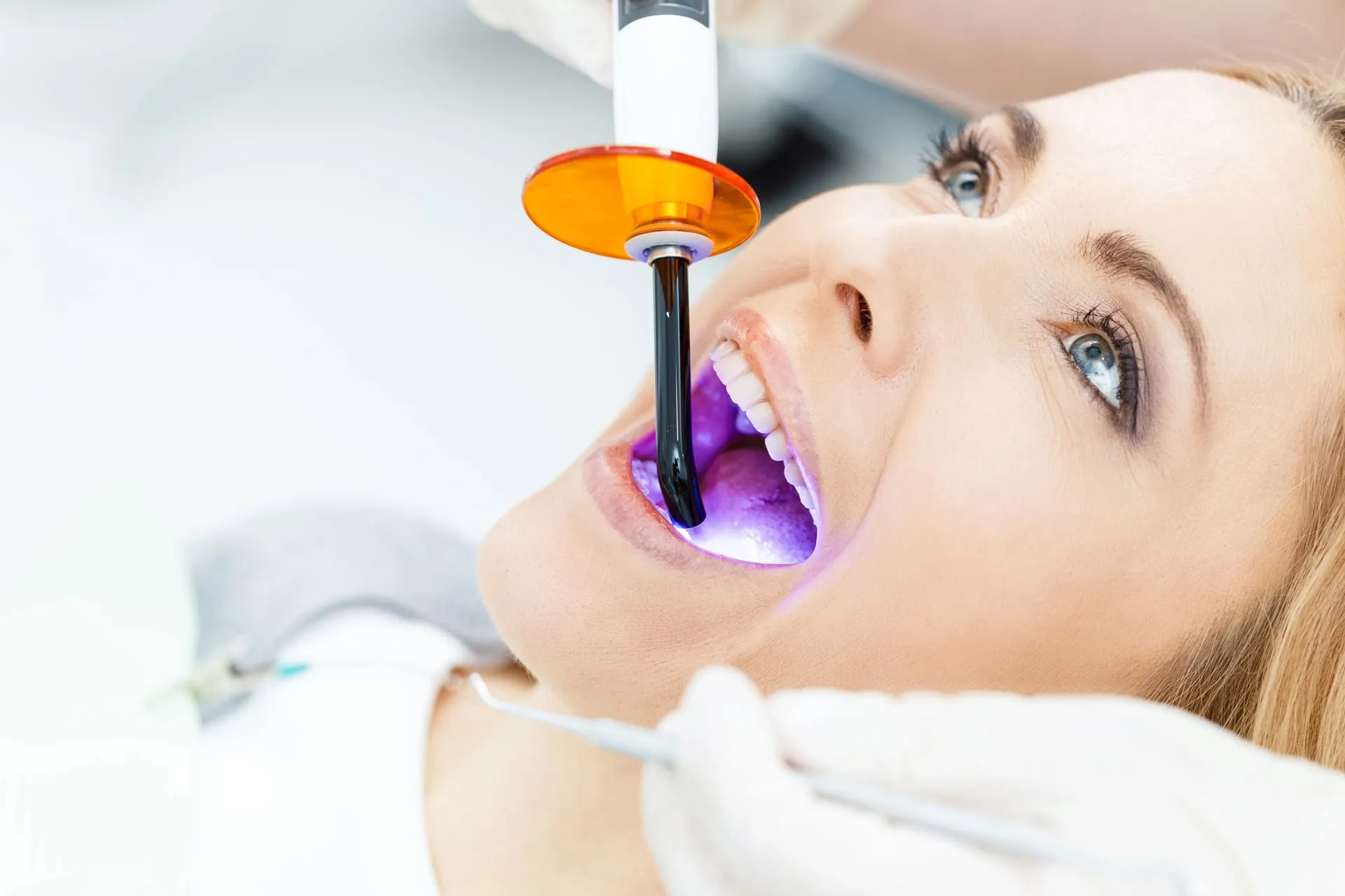 Beyond Smiles Family Dental – Trusted Dentist Bella Vista, Hills Area, Glenwood & Emergency Dental Care