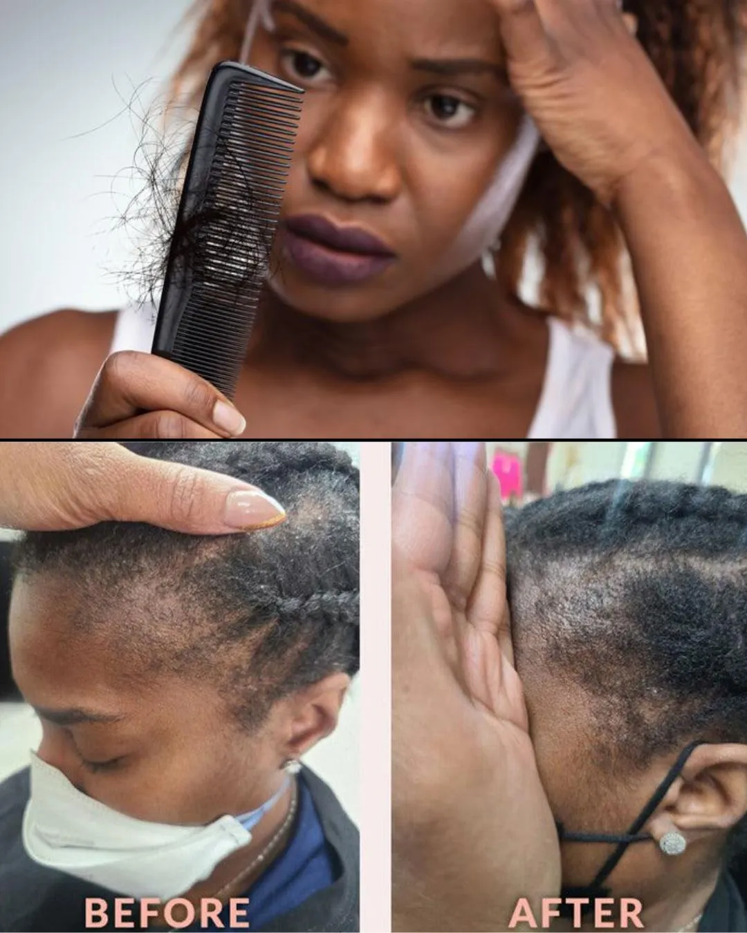 Is My Hair Loss Permanent NYC: Best Solutions for Thinning Hair in 2026