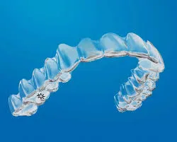 Invisalign in Kitchener: Comfortable, Clear, and Effective Orthodontic Care