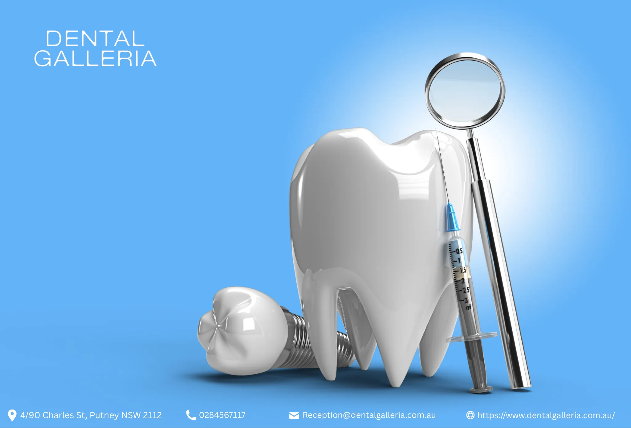 When Should You Get Dental Implants in Ryde for Missing Teeth