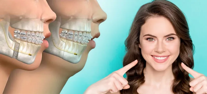 Oral and Maxillofacial Surgery Recovery Tips for Faster Healing