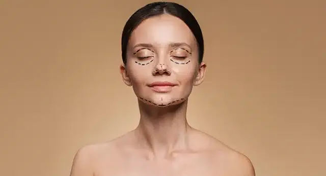 Facelift Surgery in Delhi - Dr Rajat Gupta