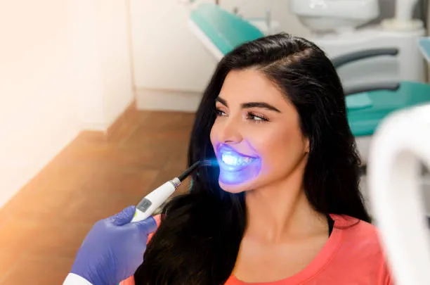 The Ultimate Guide to Teeth Whitening for a Dazzling Smile