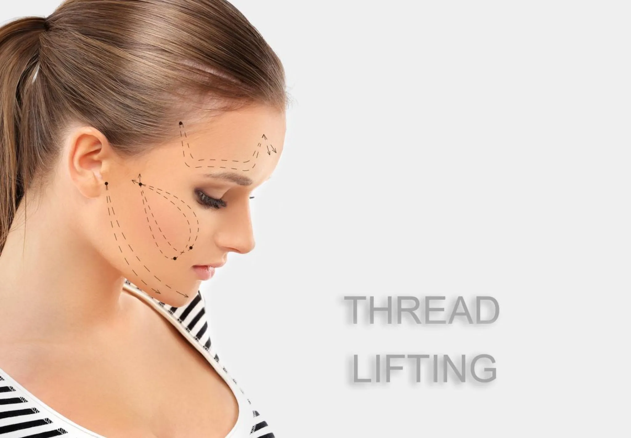 Why Thread Lift Is Becoming Popular in Cosmetic Treatments