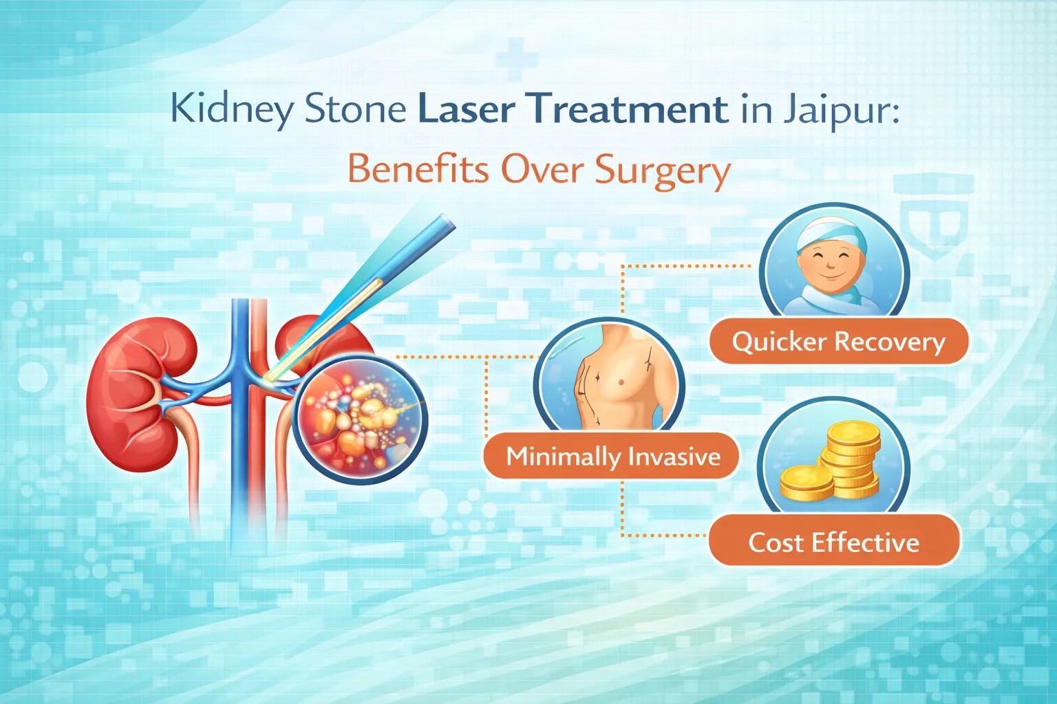 Kidney Stone Laser Treatment in Jaipur: Benefits Over Surgery