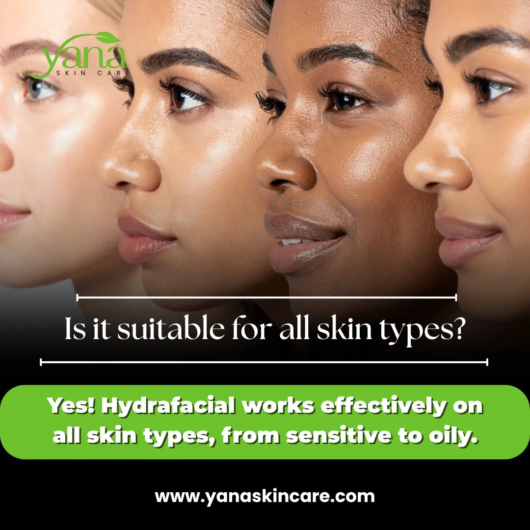 Why Hydrafacial in Houston, TX   is the Best Choice for Glowing Skin – A Guide by yana