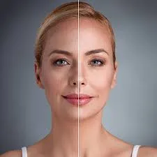 Deep Plane Facelift vs. Facelift Surgery UAE: What It Feels Like When You Actually Go Through It