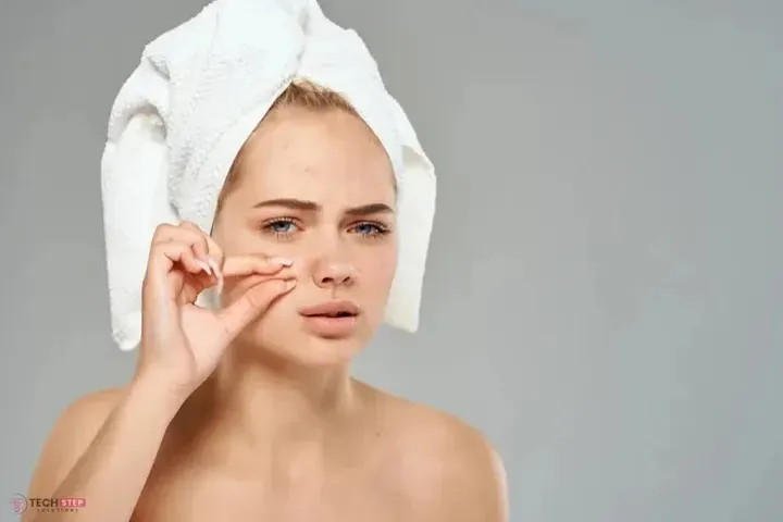 Effective Acne Treatment Houston with Laser Genesis