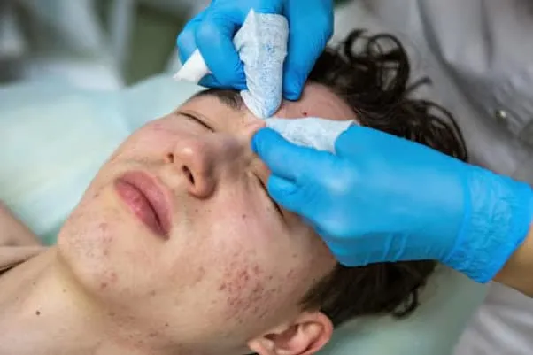 How to Choose the Best Hyperpigmentation Clinic in Bristol