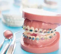 Where can I get Invisalign in Roswell with affordable financing options?