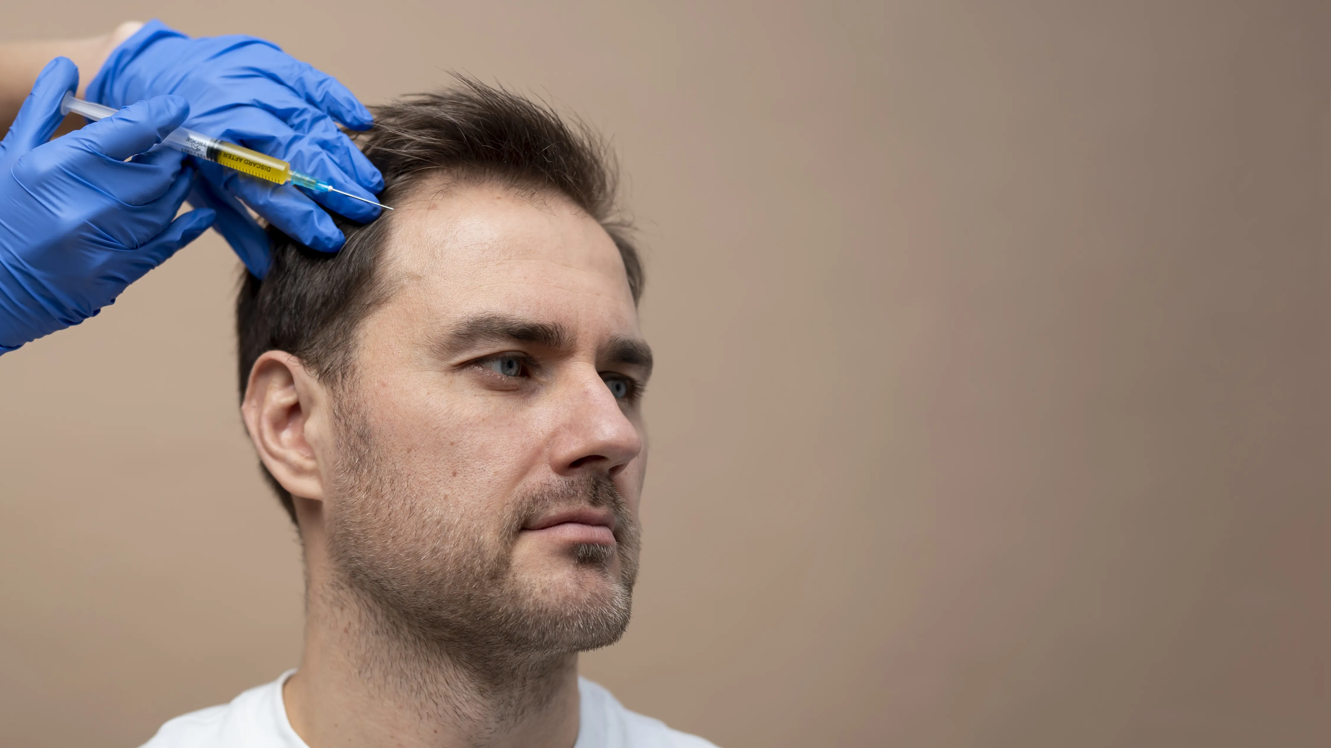 Unshaven Hair Transplant Turkey: A Day-by-Day Experience of Discreet Hair Restoration