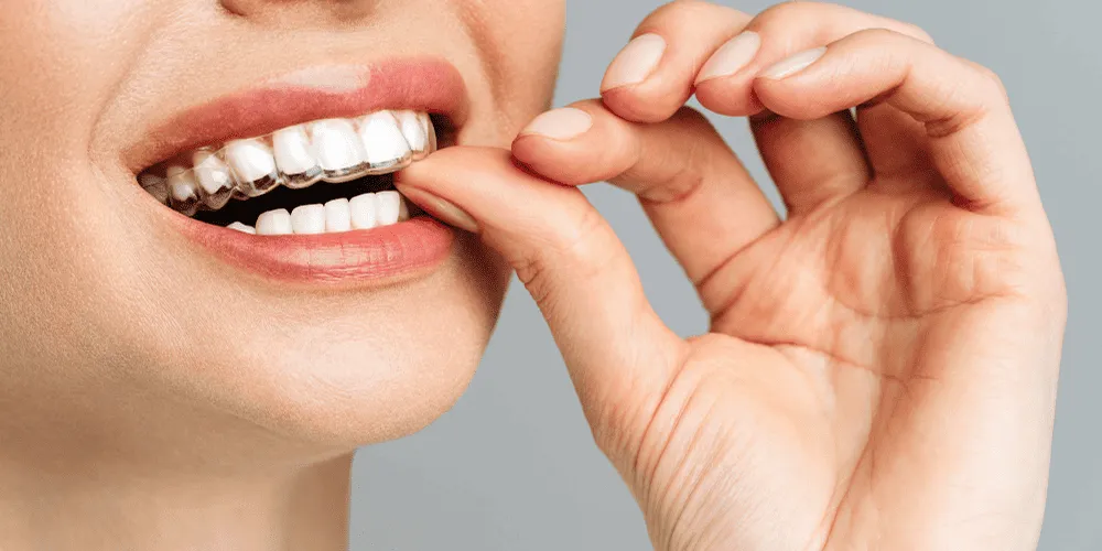 Where to Get Affordable Denture Implants in Portland ?