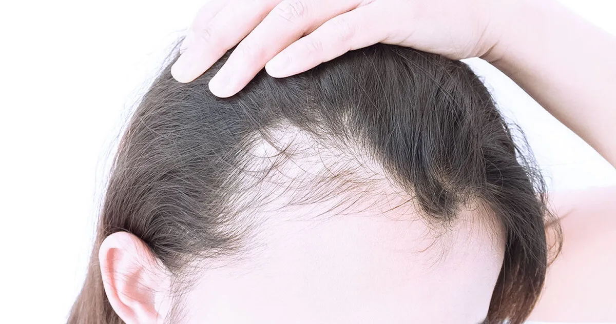 Hair Thinning Treatment: Causes, Solutions and What Really Works