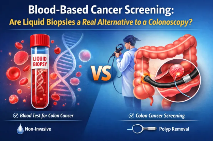 Blood-Based Cancer Screening: Are Liquid Biopsies a Real Alternative to a Colonoscopy?