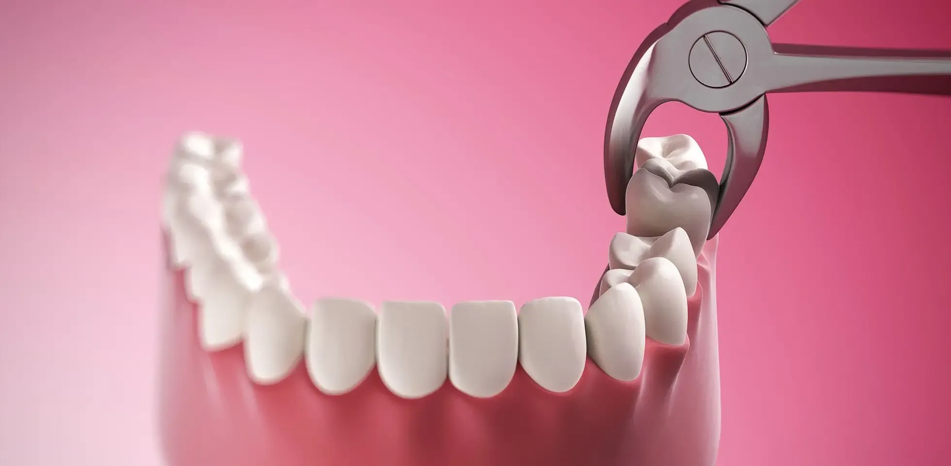From Consultation to Crown: A Real Patient's Dental Implant Journey in New York