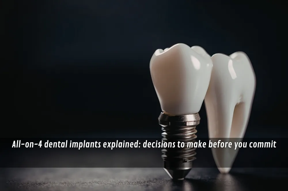 All-on-4 dental implants explained: decisions to make before you commit