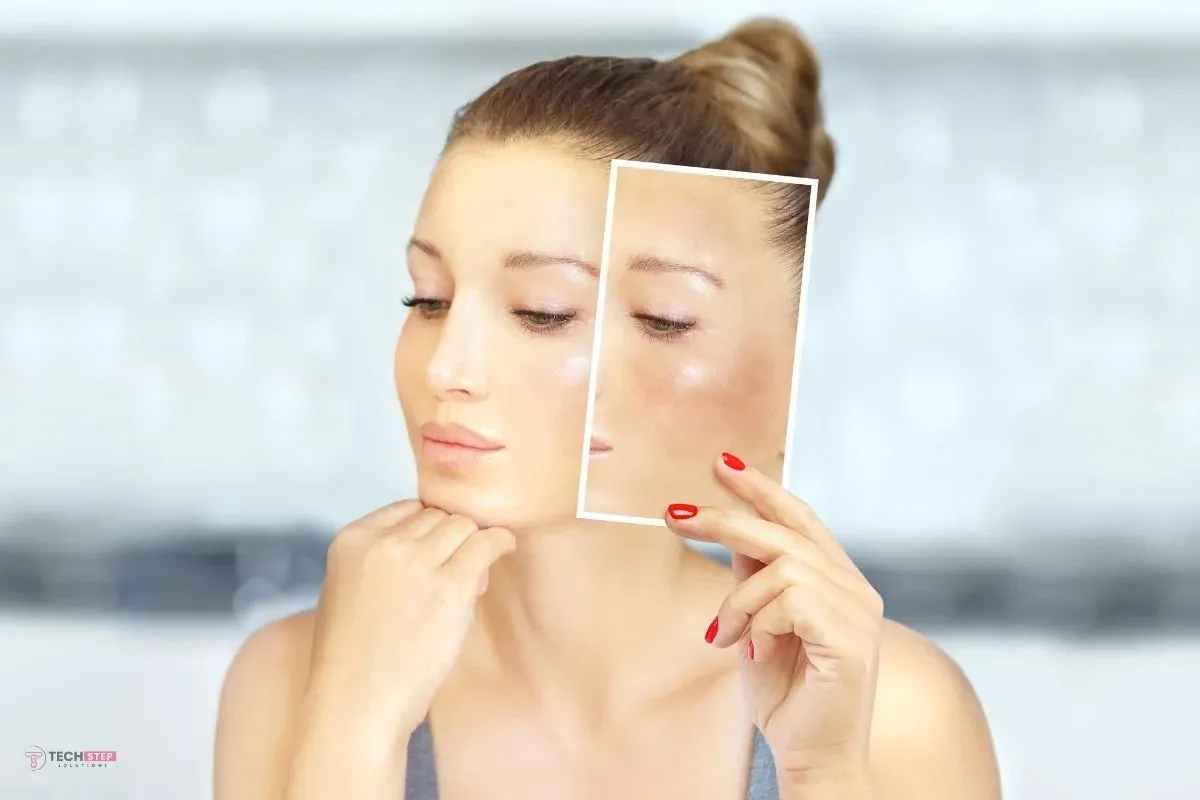 Hyperpigmentation Treatment Houston: What Works, What Doesn’t, and How to Get Clear Skin Faster: