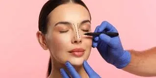 Achieve Natural Nose Contours with Rhinoplasty in Islamabad