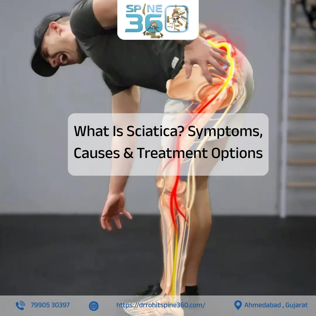 What Is Sciatica? Symptoms, Causes & Treatment Options
