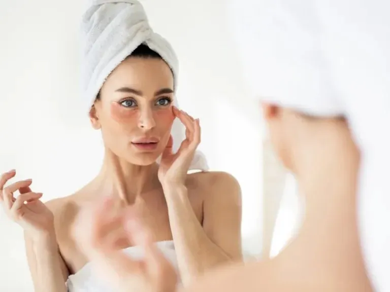 How to Get Rid of Redness on Face | Houston USA