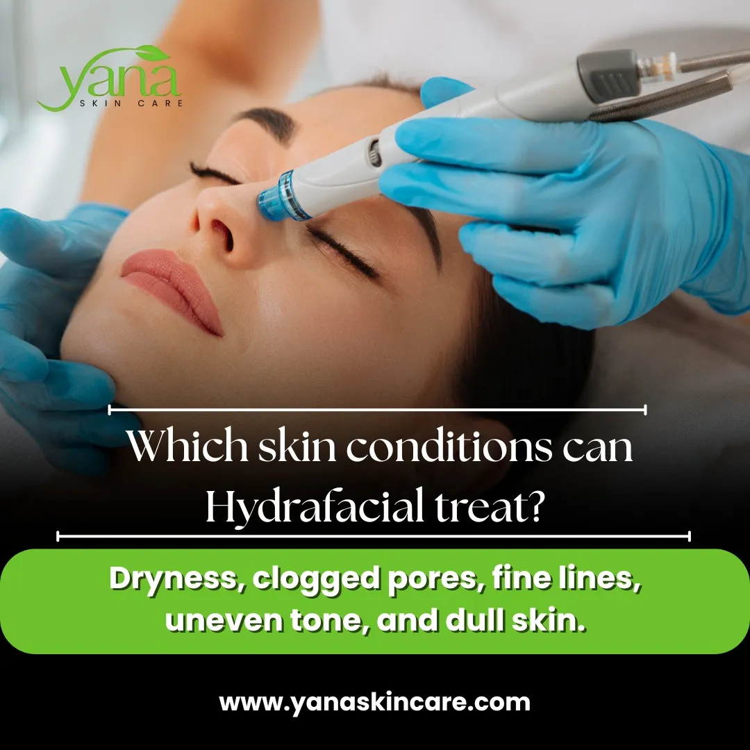 Hyperpigmentation Treatment Houston