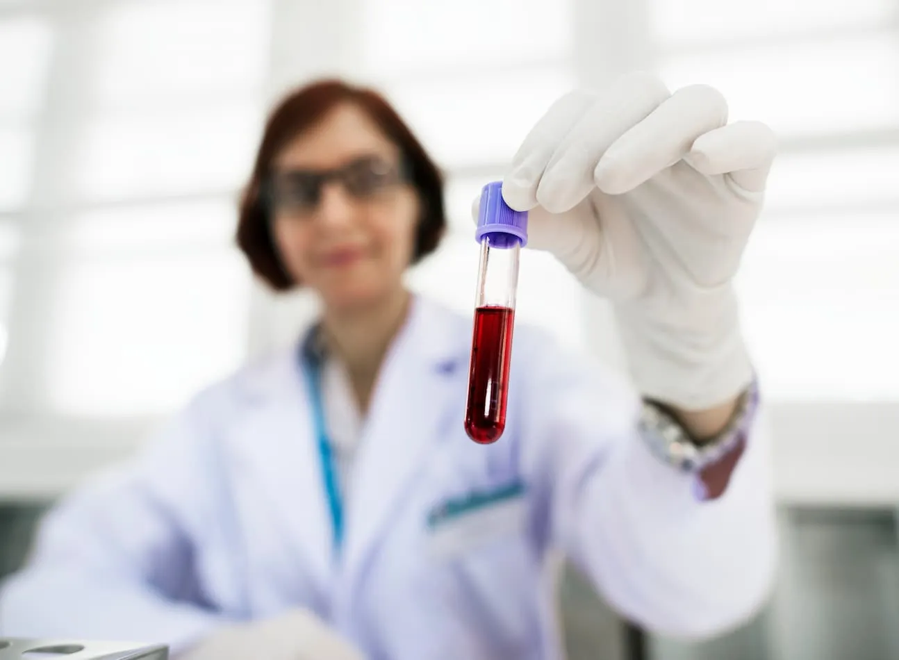 Karyotype Blood Test: Purpose, Procedure & Results Explained
