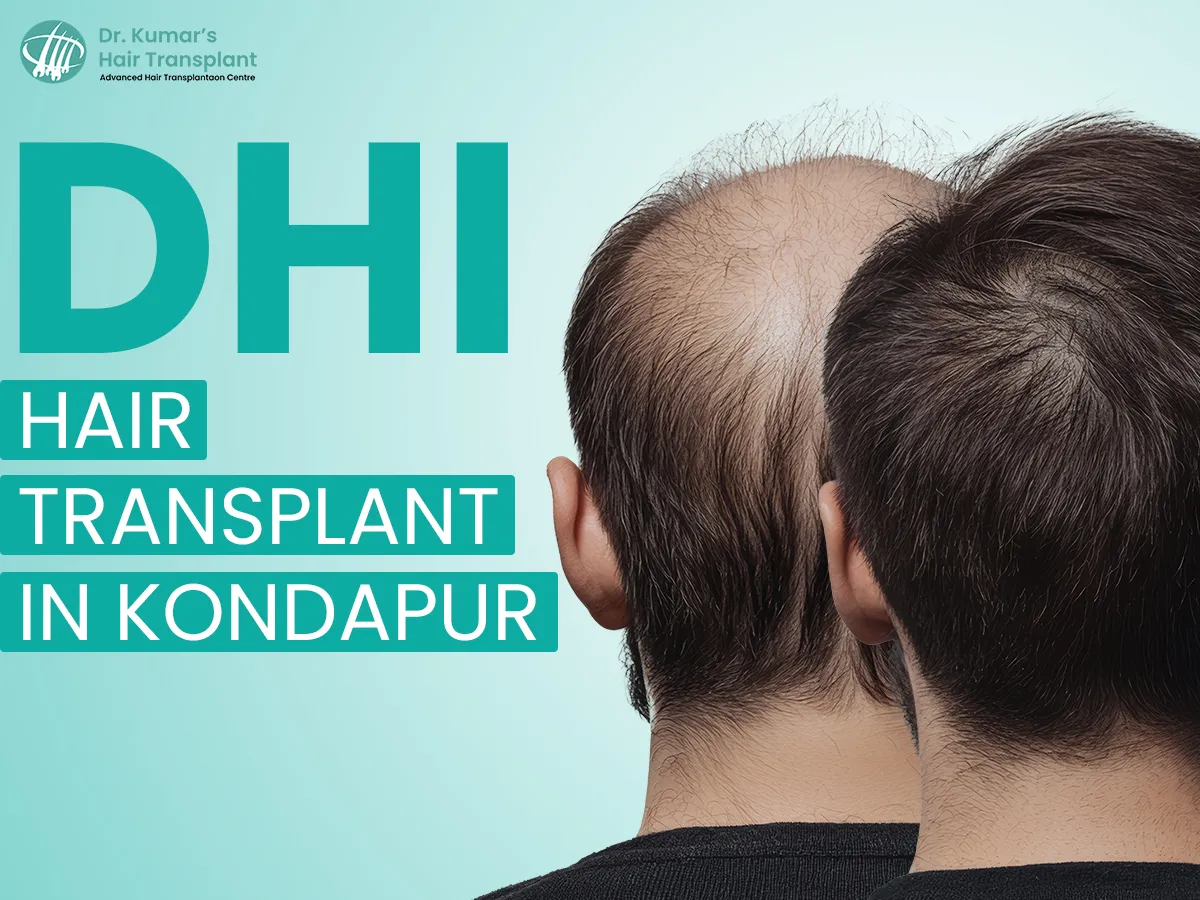What is the Science Behind DHI Hair Transplant?