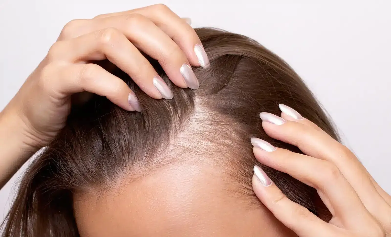 Complete Guide to Dandruff Treatment and Removal