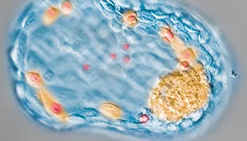 How Long Does Donor Egg IVF Abroad Really Take? A Week-by-Week Timeline