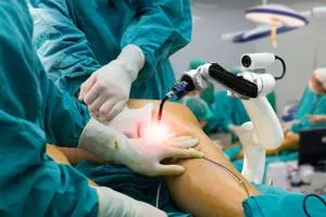 Robotic Knee Replacement Surgery: Precision and Recovery