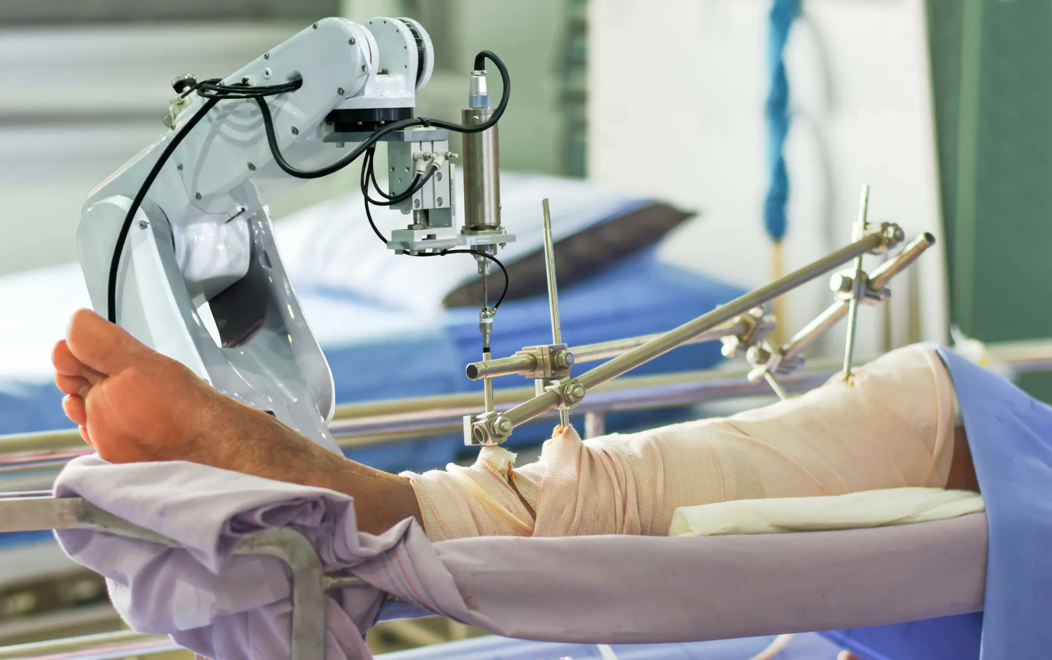 Robotic Knee Replacement Surgery: Precision and Recovery