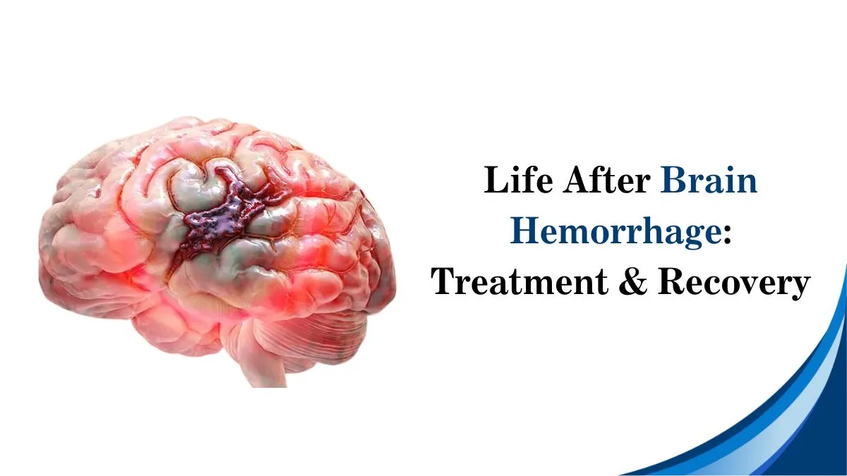 Life After Brain Hemorrhage: Treatment & Recovery