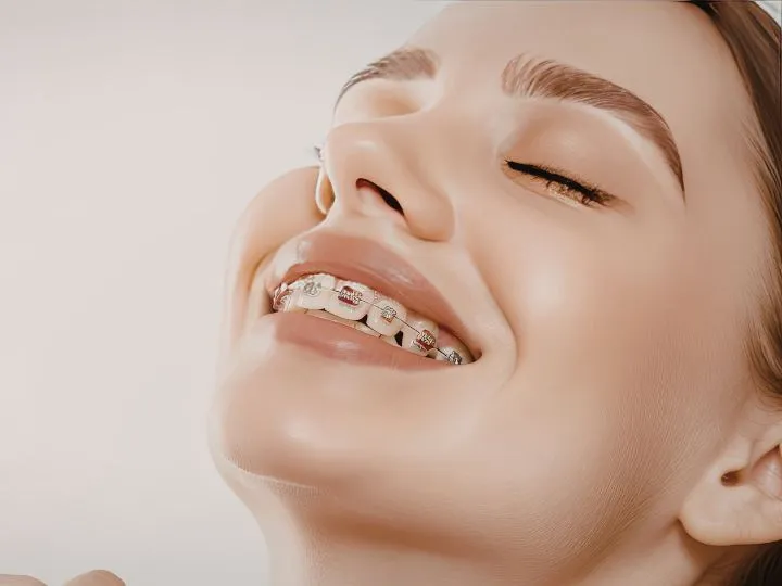 10 Helpful Tips for Managing Braces Cost in Australia