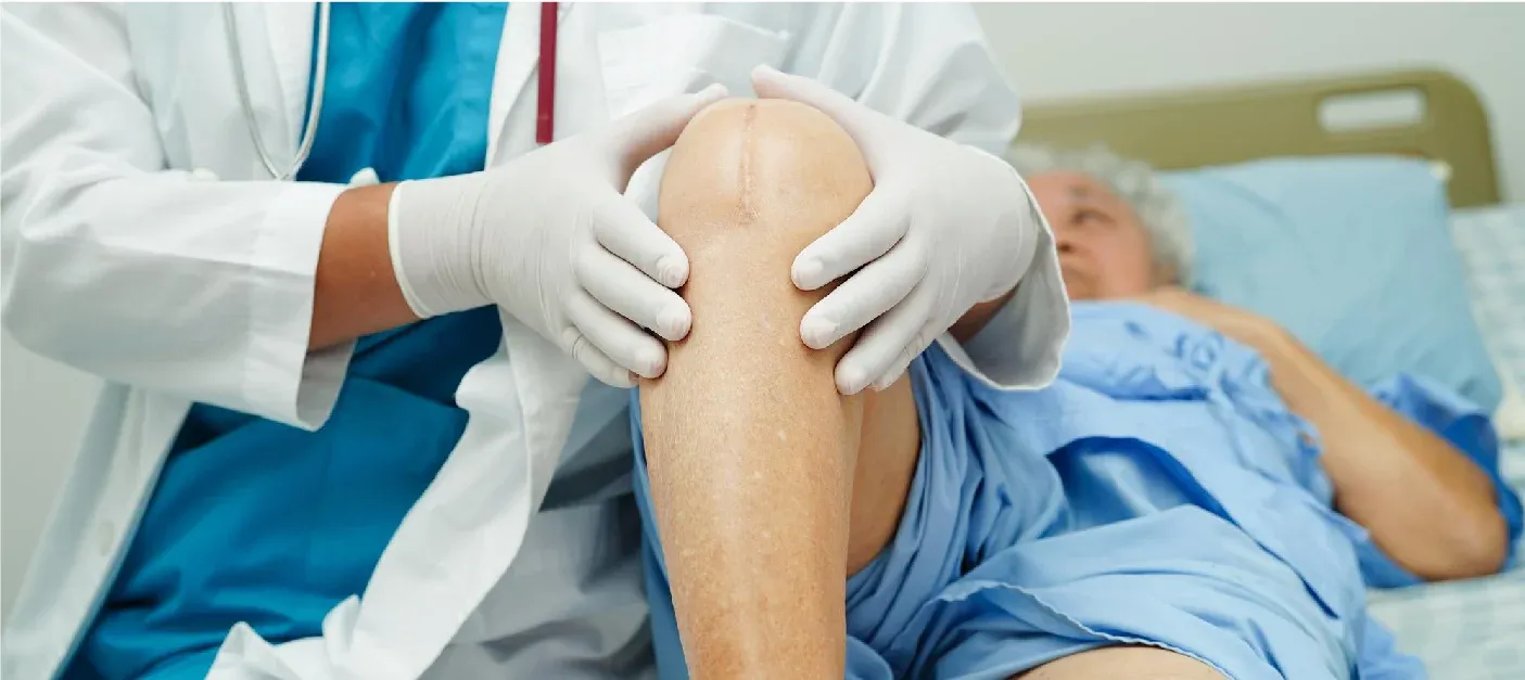 Questions to Ask the Knee Replacement Surgeon in Delhi