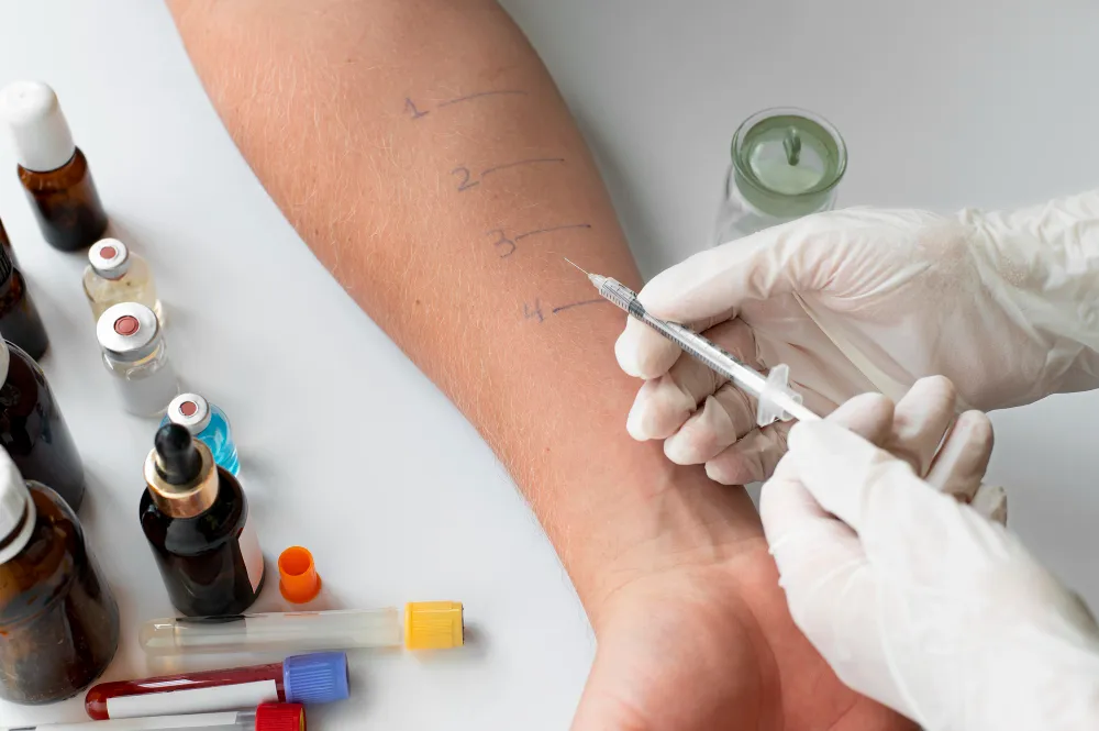 Signs You Need to Visit an Allergy Test Clinic in Dublin